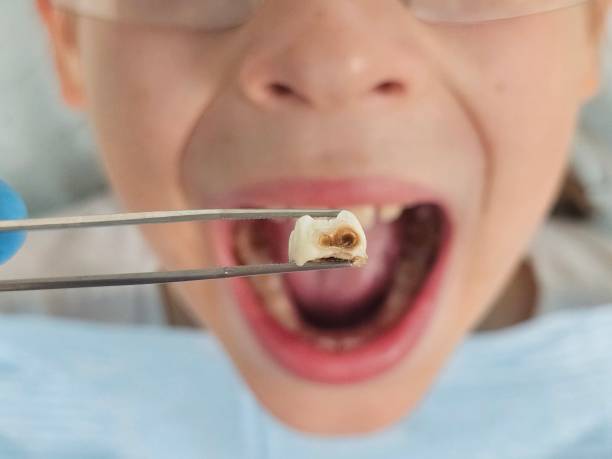 Best Orthodontic Emergency Dentist in Gibraltar, MI